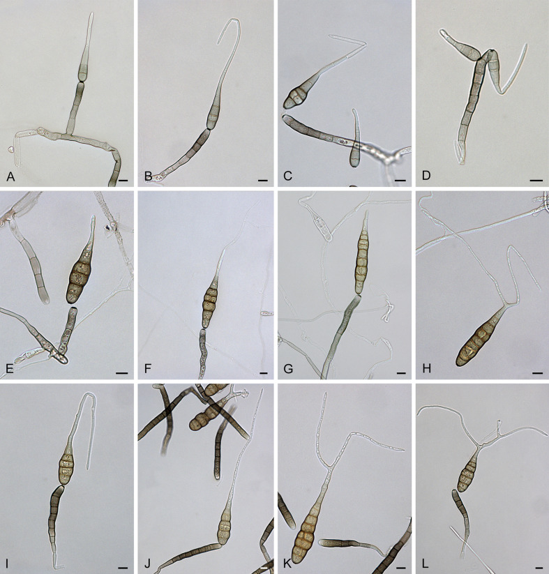 Alternaria porri: conidia and conidiophores.