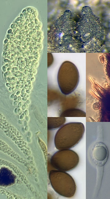 Reproductive structures of Arnium leporinum [Image credit: Andrew Miller, University of Illinois, Illinois Natural History Survey]