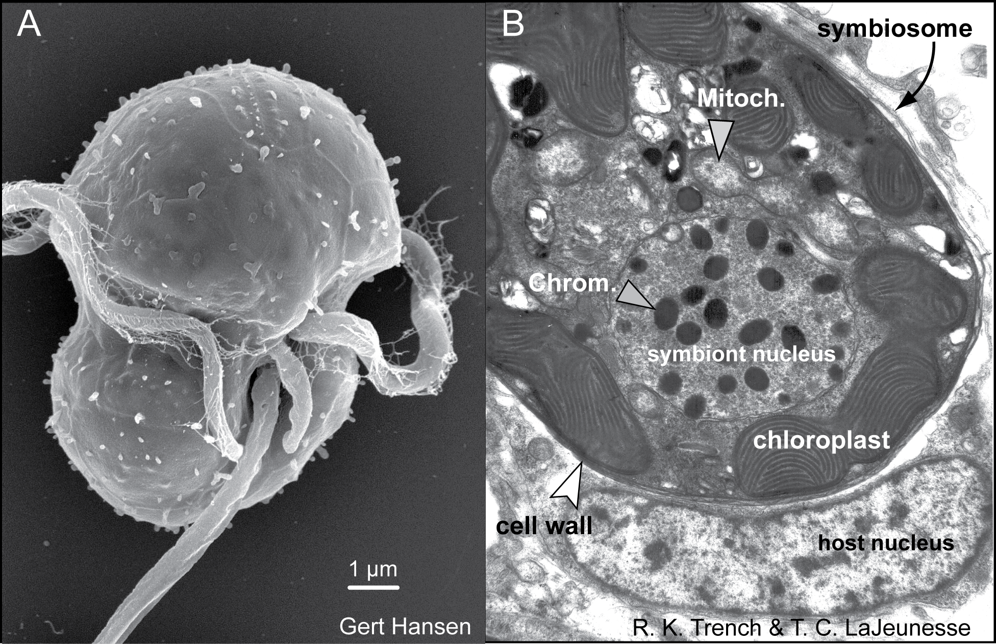 (A) Electron micrographs of a Symbiodinium mastigote (motile cell)
with characteristic gymnodinioid morphology and (B) the coccoid
cell in hospitæ. Image and caption from Wikipedia under CC BY-SA 4.0 by Dr. Alison Lewis