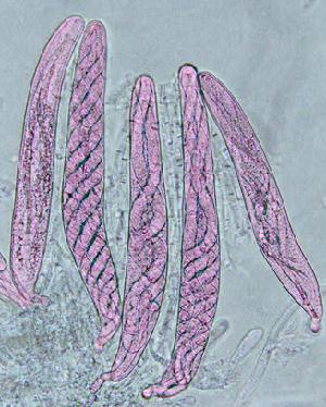 Photo of Cochliobolus heterostrophus C5 v3.0