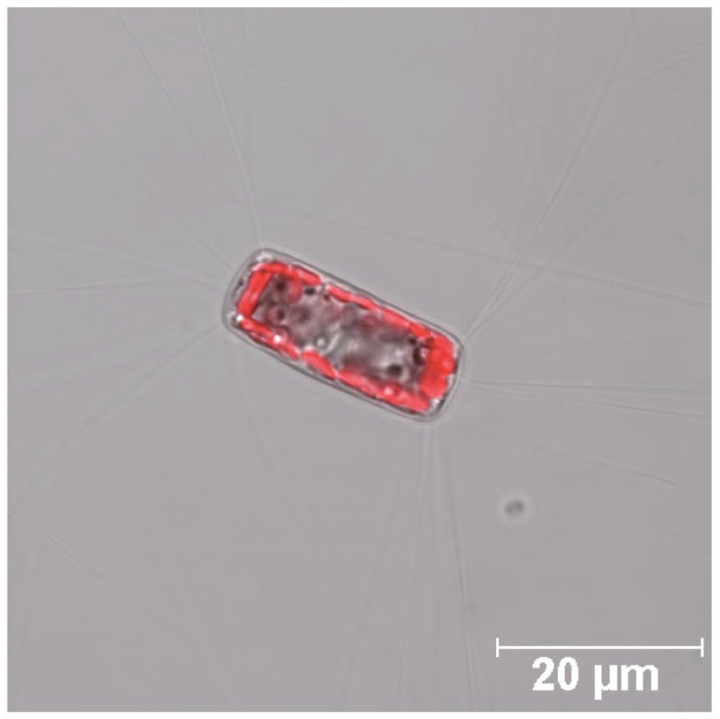 Light micrograph of C. weissflogii