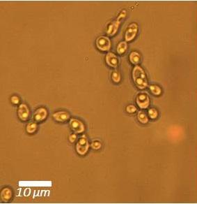 Cryptococcus terricola