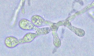 Fig 3) Gemma (chlamydospores) of D. ornata produced terminally or in chains. Image by Greg Bonito.