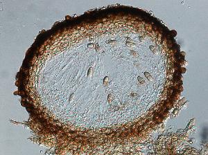 Longitudinal section through an ascoma of Dothidotthia symphoricarpi