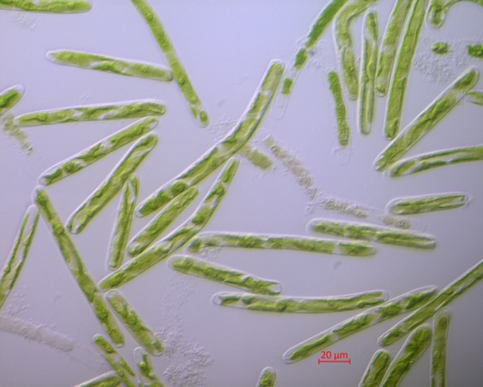 Photo of Mesotaenium kramstae NIES-657 in liquid culture [Image credit: Xuehuan Feng]