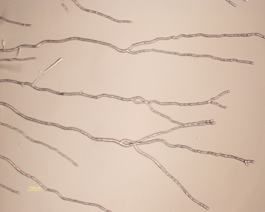 Hyphae of Phoma multirostrata.