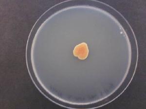 Photo of Protomyces lactucaedebilis 12-1054 v1.0