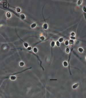 Rozalla allomyces - single cell project
