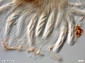 Asci with ascospores and pseudoparaphyses.