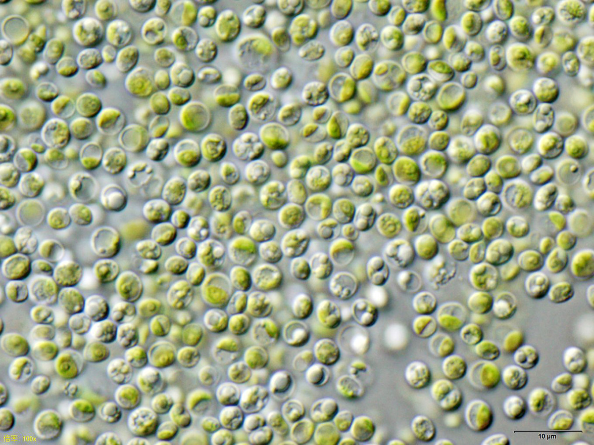 Trebouxiophyceae example species Chlorella vulgaris NIES-2170
[Image credit: User:NEON / User:NEON_ja, <a
href="https://creativecommons.org/licenses/by-sa/3.0"
target="_new">CC BY-SA 3.0</a>, via <a
href="https://commons.wikimedia.org/wiki/File:Chlorella_vulgaris_NIES2170.jpg"
 target="_new">Wikimedia Commons</a>]