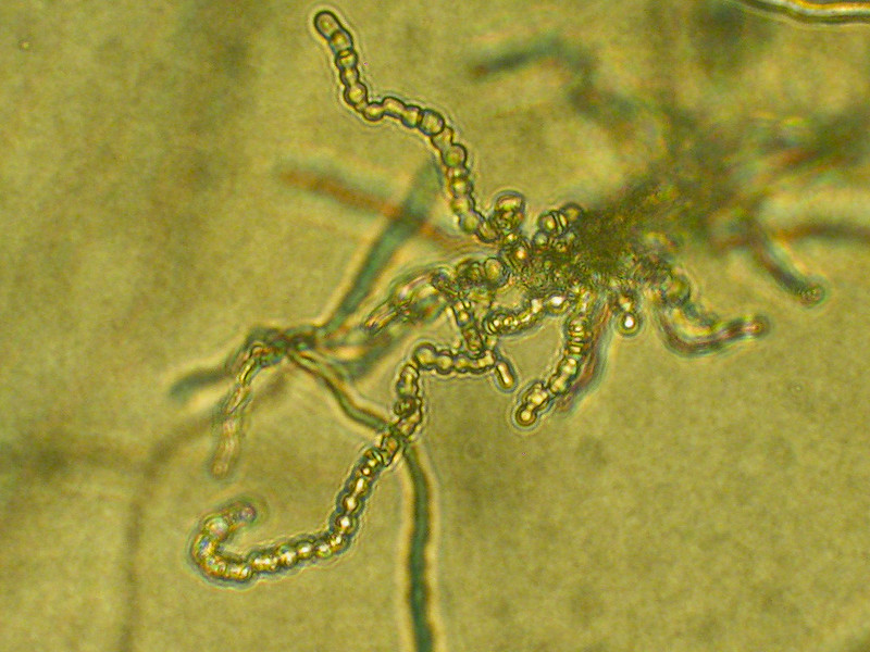 Trichophyton violaceum